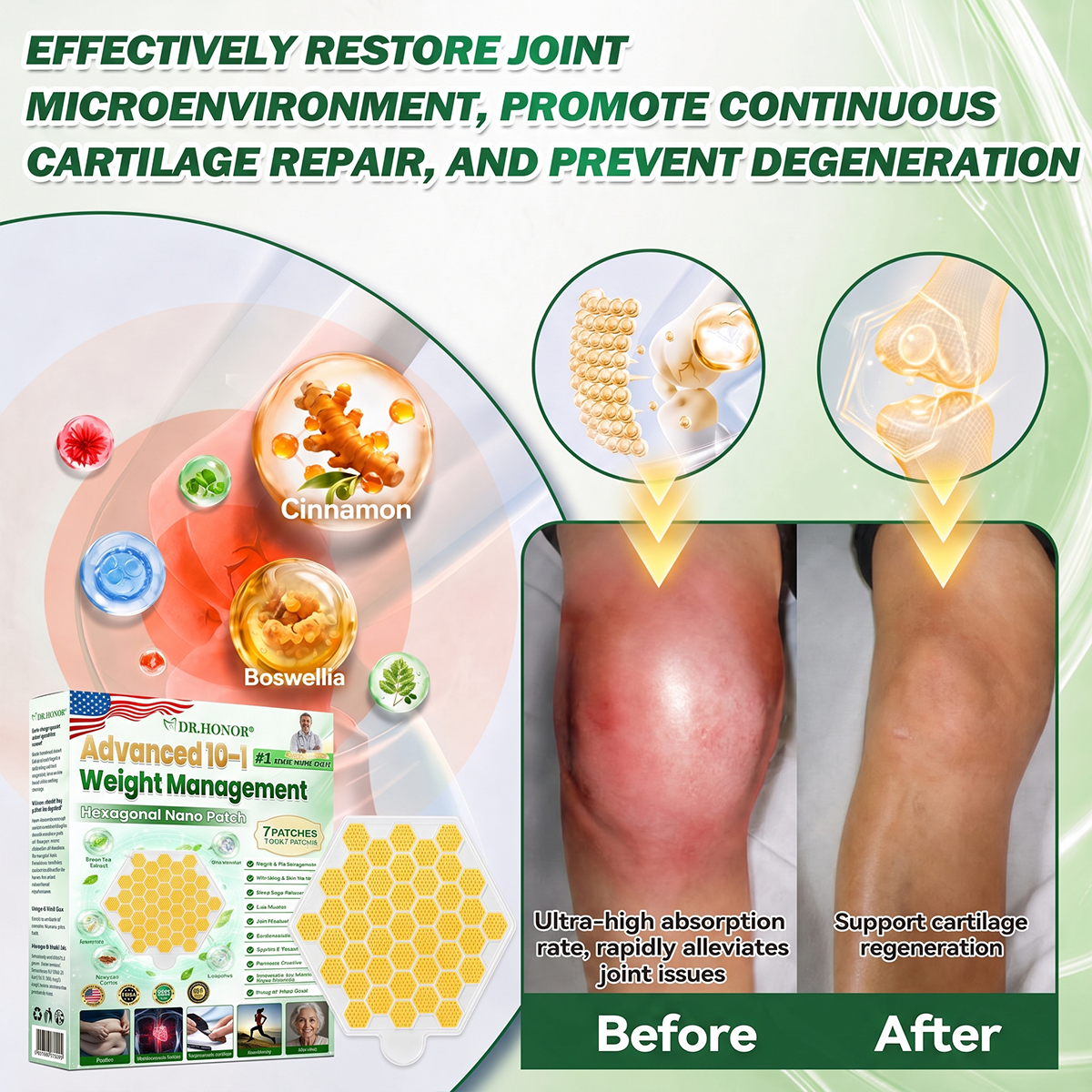 🔸🔸🔸𝑶𝒇𝒇𝒊𝒄𝒊𝒂𝒍 𝑺𝒕𝒐𝒓𝒆  | 1️⃣DR.HONOR® 𝐴𝑑𝑣𝑎𝑛𝑐𝑒𝑑 𝐻𝑒𝑥𝑎𝑔𝑜𝑛𝑎𝑙 𝑁𝑎𝑛𝑜 𝑊𝑒𝑖𝑔ℎ𝑡 𝑀𝑎𝑛𝑎𝑔𝑒𝑚𝑒𝑛𝑡 𝑃𝑎𝑡𝑐ℎ