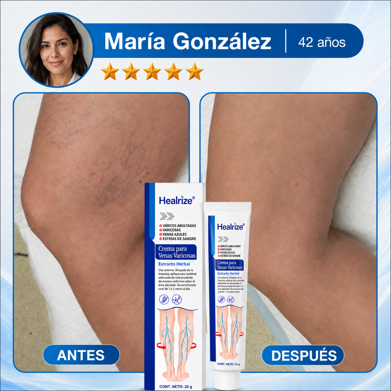 Healrize® Crema para Várices y Circulación – Piernas más ligeras y apariencia visiblemente mejorada