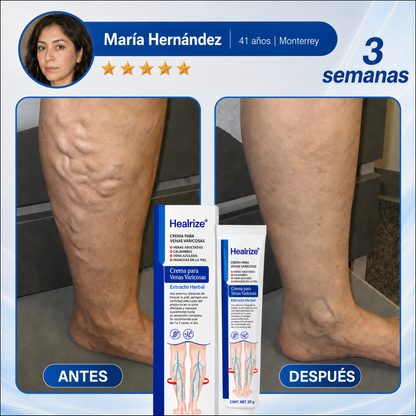 Healrize® Crema para Várices y Circulación – Piernas más ligeras y apariencia visiblemente mejorada