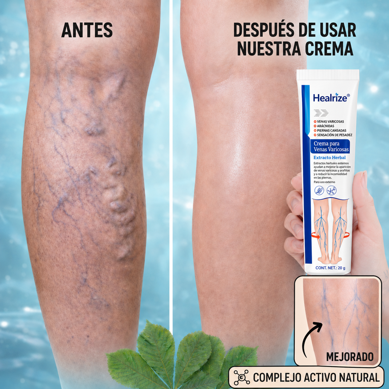 Healrize® Crema para Várices y Circulación – Piernas más ligeras y apariencia visiblemente mejorada