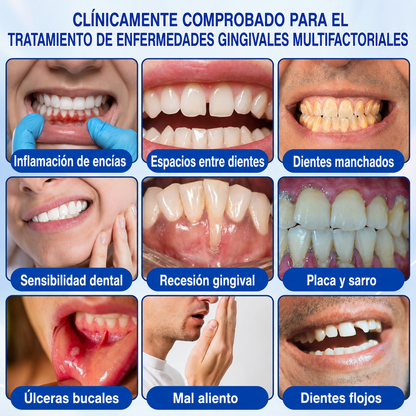🇲🇽🍄🦷1️⃣ HEATWOLF® GumRevive Gel Reparador Periodontal