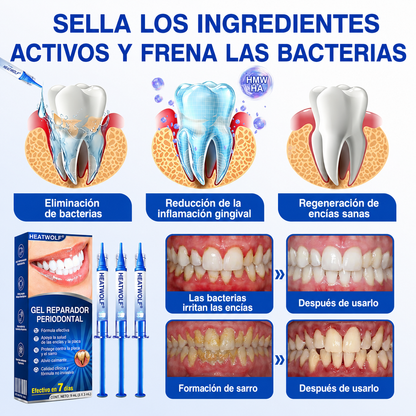 🇲🇽🍄🦷1️⃣ HEATWOLF® GumRevive Gel Reparador Periodontal