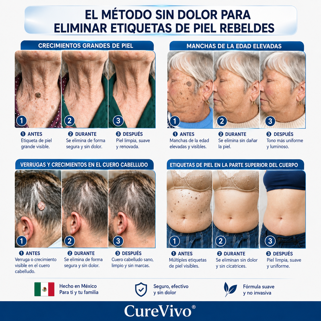 🥑1️⃣ CureVivo® Crema de 7 Días para Acrocordones y Manchas (Fórmula sin dolor · Sin cicatrices)