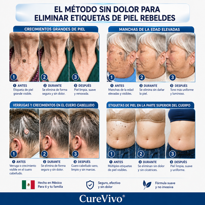 🥑1️⃣ CureVivo® Crema de 7 Días para Acrocordones y Manchas (Fórmula sin dolor · Sin cicatrices)