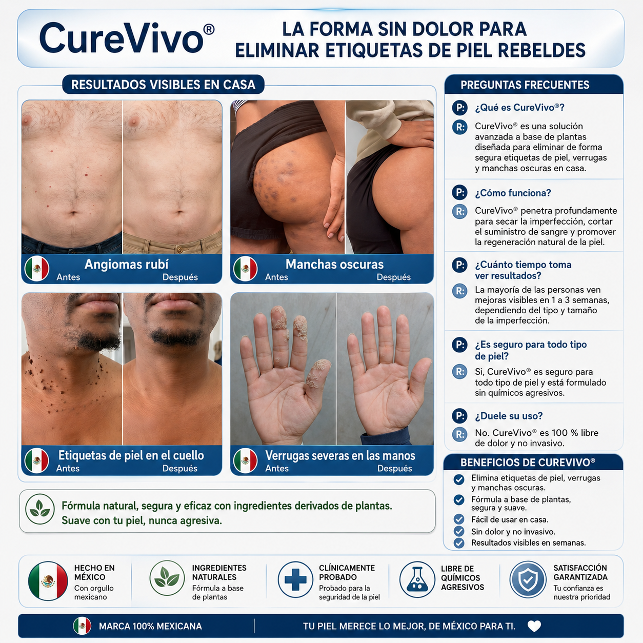 🥑1️⃣ CureVivo® Crema de 7 Días para Acrocordones y Manchas (Fórmula sin dolor · Sin cicatrices)