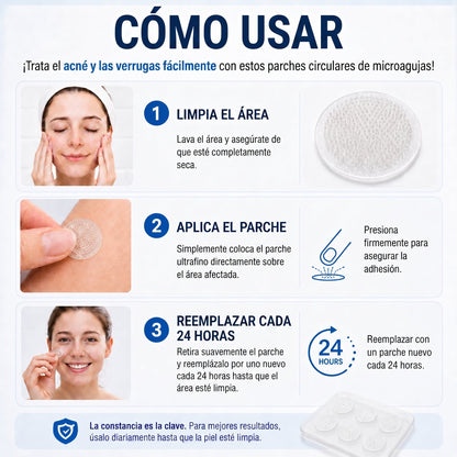 🍄1️⃣𝑻𝒊𝒆𝒏𝒅𝒂 𝑶𝒇𝒊𝒄𝒊𝒂𝒍 | 𝑻𝒓𝒊𝒍𝒖𝒎𝒊𝒂® 🌿 𝑀𝑖𝑐𝑟𝑜𝑎𝑔𝑢𝑗𝑎𝑠 𝑃𝑖𝑒𝑙 𝐼𝑚𝑝𝑒𝑐𝑎𝑏𝑙𝑒 𝐸𝑙𝑖𝑚𝑖𝑛𝑎𝑐𝑖ó𝑛 𝐷𝑒 𝑉𝑒𝑟𝑟𝑢𝑔𝑎𝑠 𝑃𝑎𝑟𝑐ℎ𝑒 (𝑃𝑎𝑟𝑎 𝑎𝑐𝑟𝑜𝑐𝑜𝑟𝑑𝑜𝑛𝑒𝑠, 𝑝𝑒𝑞𝑢𝑒ñ𝑎𝑠 𝑖𝑚𝑝𝑒𝑟𝑓𝑒𝑐𝑐𝑖𝑜𝑛𝑒𝑠 𝑐𝑢𝑡á𝑛𝑒𝑎𝑠, 𝑣𝑒𝑟𝑟𝑢𝑔𝑎𝑠, 𝑙𝑢𝑛𝑎𝑟𝑒𝑠, 𝑚𝑎𝑛𝑐ℎ𝑎𝑠 𝑑𝑒 𝑙𝑎 𝑒𝑑𝑎𝑑 𝑦 𝑝𝑟𝑜𝑏𝑙𝑒𝑚𝑎𝑠 𝑑𝑒 𝑝𝑖𝑔𝑚𝑒𝑛𝑡𝑎𝑐𝑖ó𝑛.)